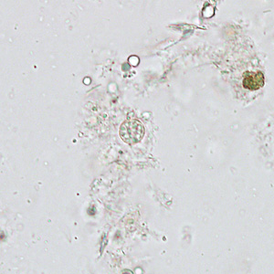 Case313_C.jpg
