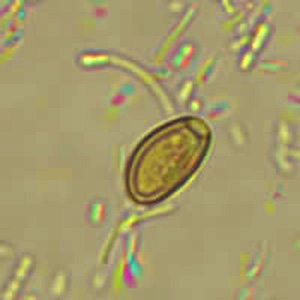 Case318_A.jpg