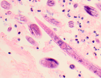 Case319_A.jpg