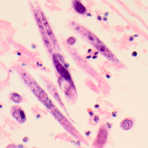 Case319_B.jpg
