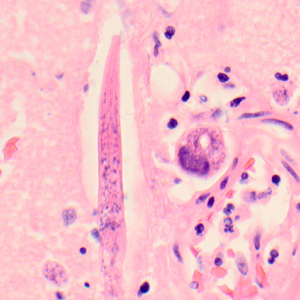 Case319_C.jpg