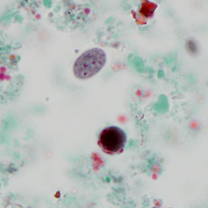 Case320_C.jpg