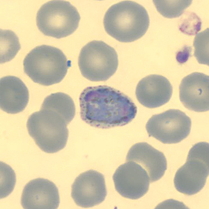 Case323_F.jpg