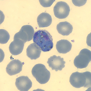 Case323_I.jpg