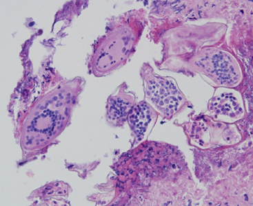 Case324_A.jpg