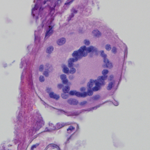 Case324_D.jpg