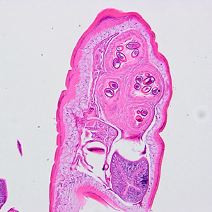 Case326_A.jpg