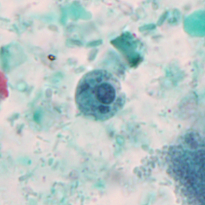Case327_A.jpg