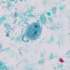 Case327_C.jpg