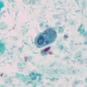 Case327_D.jpg