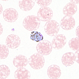 Case330_A.jpg