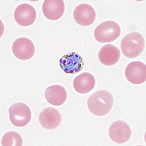 Case330_C.jpg