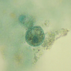 Case331_A.jpg