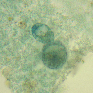 Case331_C.jpg
