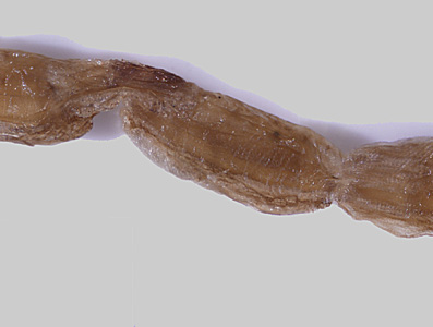 Case332_A.jpg