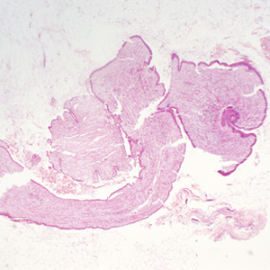 Case333_A.jpg