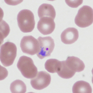 Case335_E.jpg
