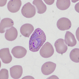 Case335_F.jpg