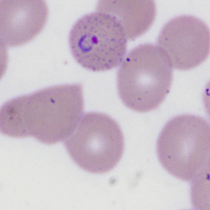 Case335_H.jpg