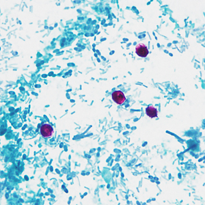 Case337_C.jpg