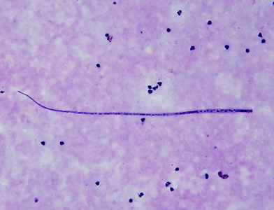 Case339_A.jpg