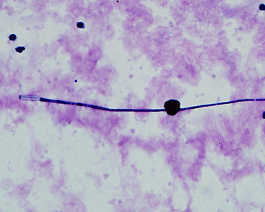 Case339_C.jpg