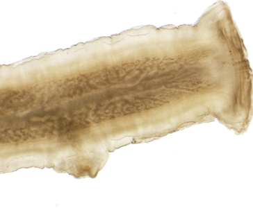 Case340_D.jpg
