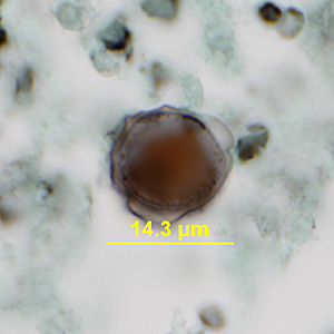 Case341_A.jpg