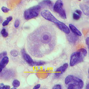 Case341_C.jpg