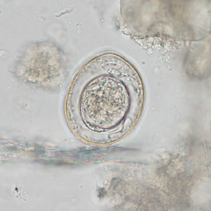 Case342_B.jpg