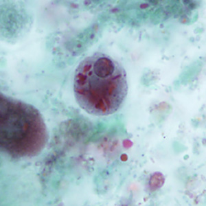 Case346_D.jpg