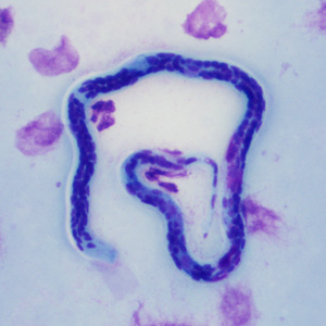 Case347_A.jpg