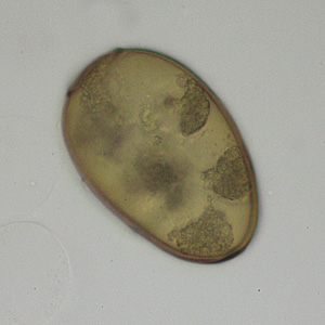 Case348_A.jpg