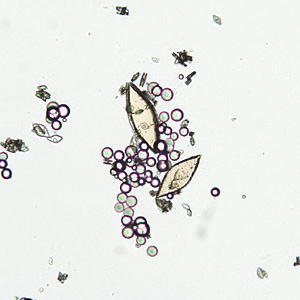 Case349_A.jpg