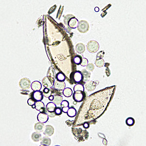Case349_B.jpg