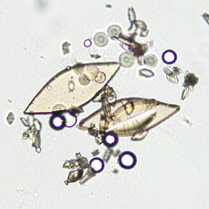 Case349_C.jpg