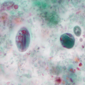 Case351_B.jpg