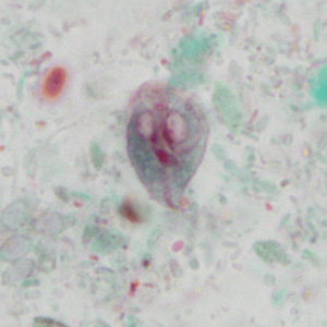 Case351_C.jpg