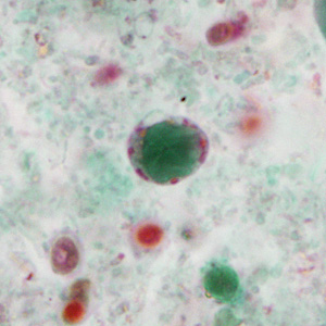 Case351_D.jpg