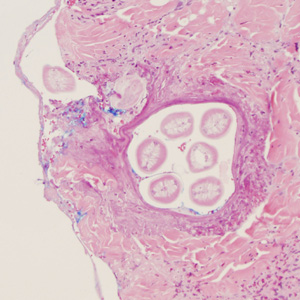Case352_A.jpg