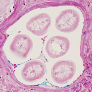 Case352_B.jpg