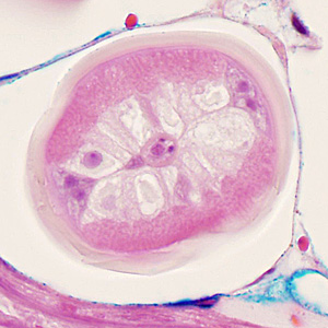 Case352_D.jpg