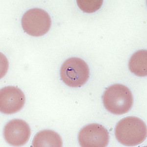 Case354_A.jpg