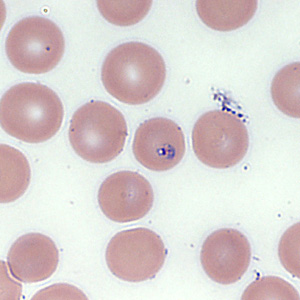 Case354_C.jpg