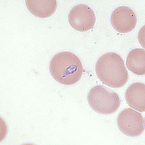 Case354_D.jpg