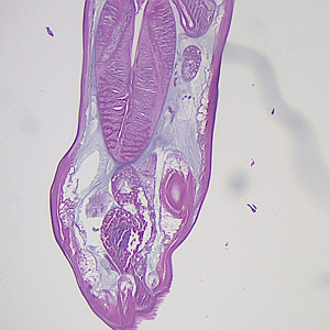 Case355_B.jpg