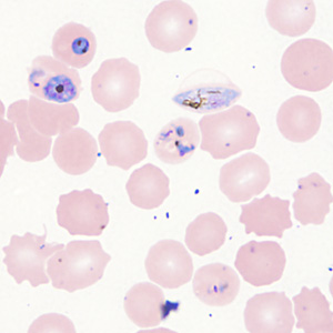 Case357_E.jpg