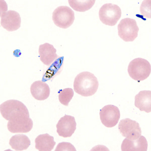 Case357_F.jpg