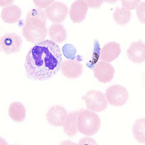Case357_G.jpg