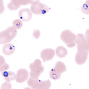 Case357_H.jpg